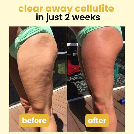 Kollagen + Stammzellen Cellulite Öl