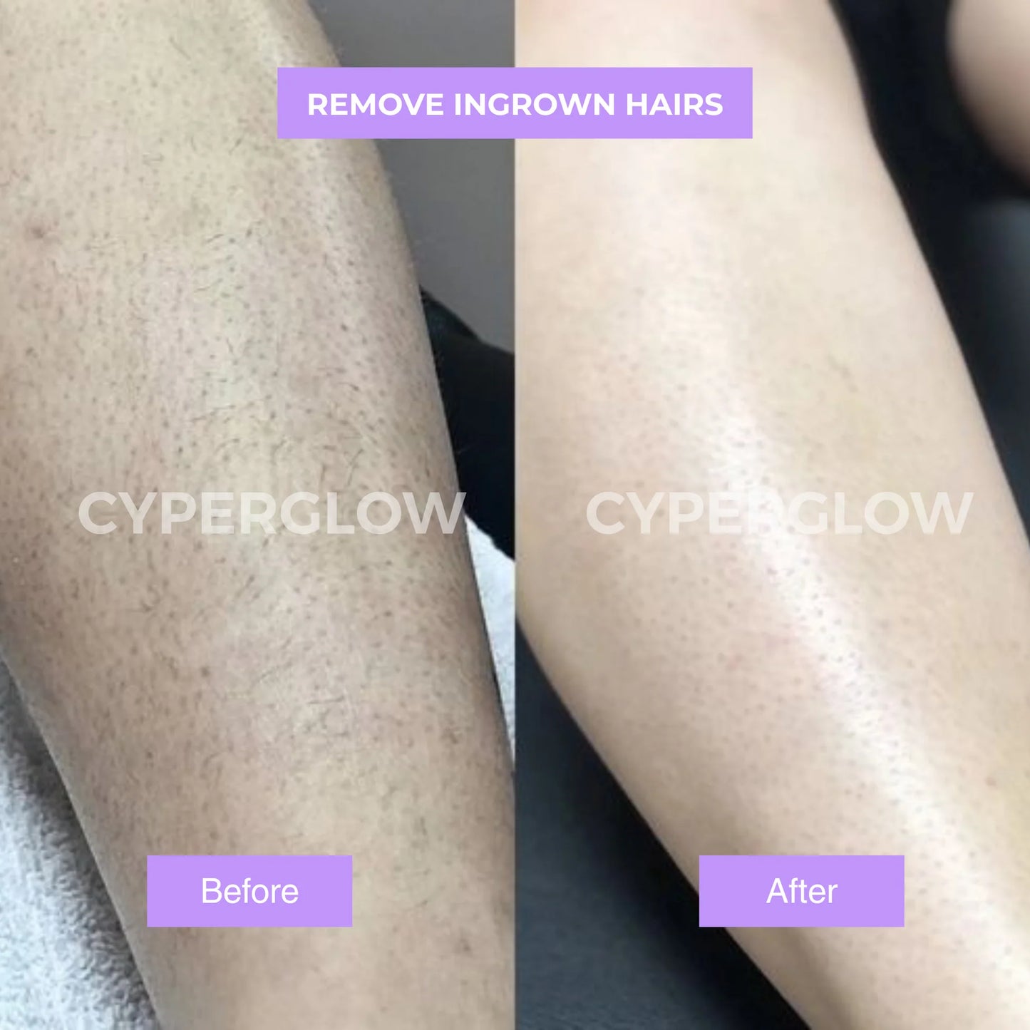 Belaro Cyper No. 9 - Premium Cyperus Rotundus Skin Serum