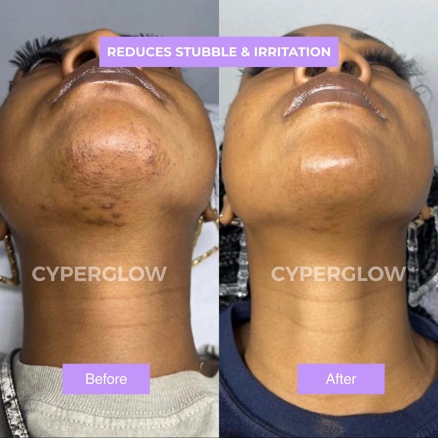 Belaro Cyper No. 9 - Premium Cyperus Rotundus Skin Serum