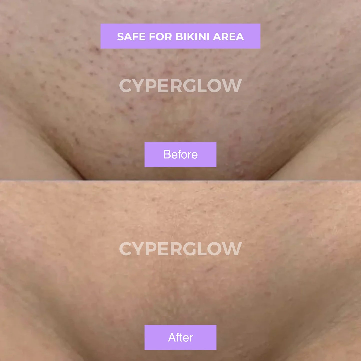 Belaro Cyper No. 9 - Premium Cyperus Rotundus Skin Serum