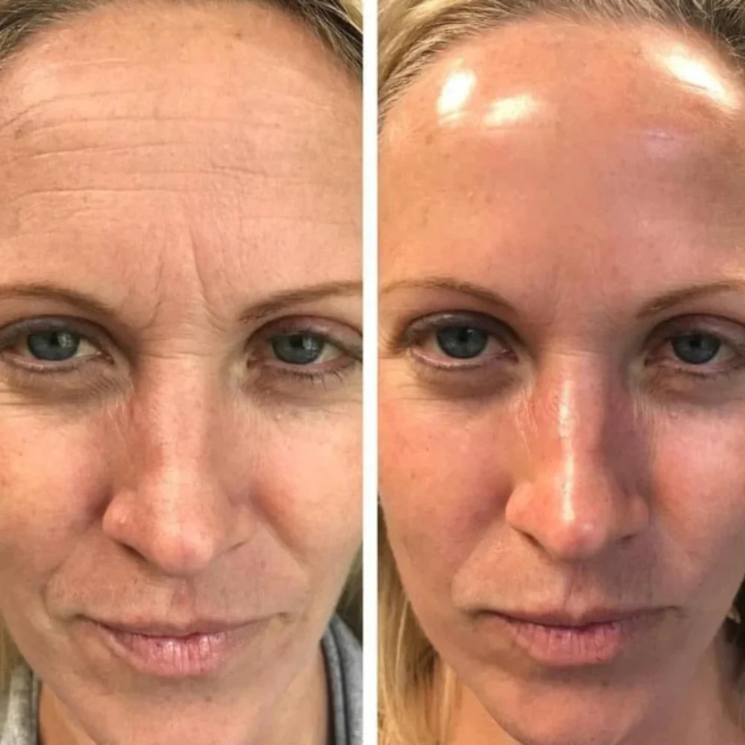 Anti-Aging-Serum