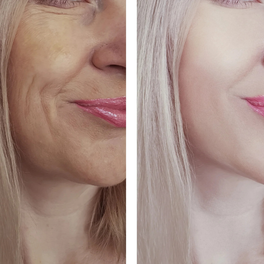 Anti-Aging-Serum