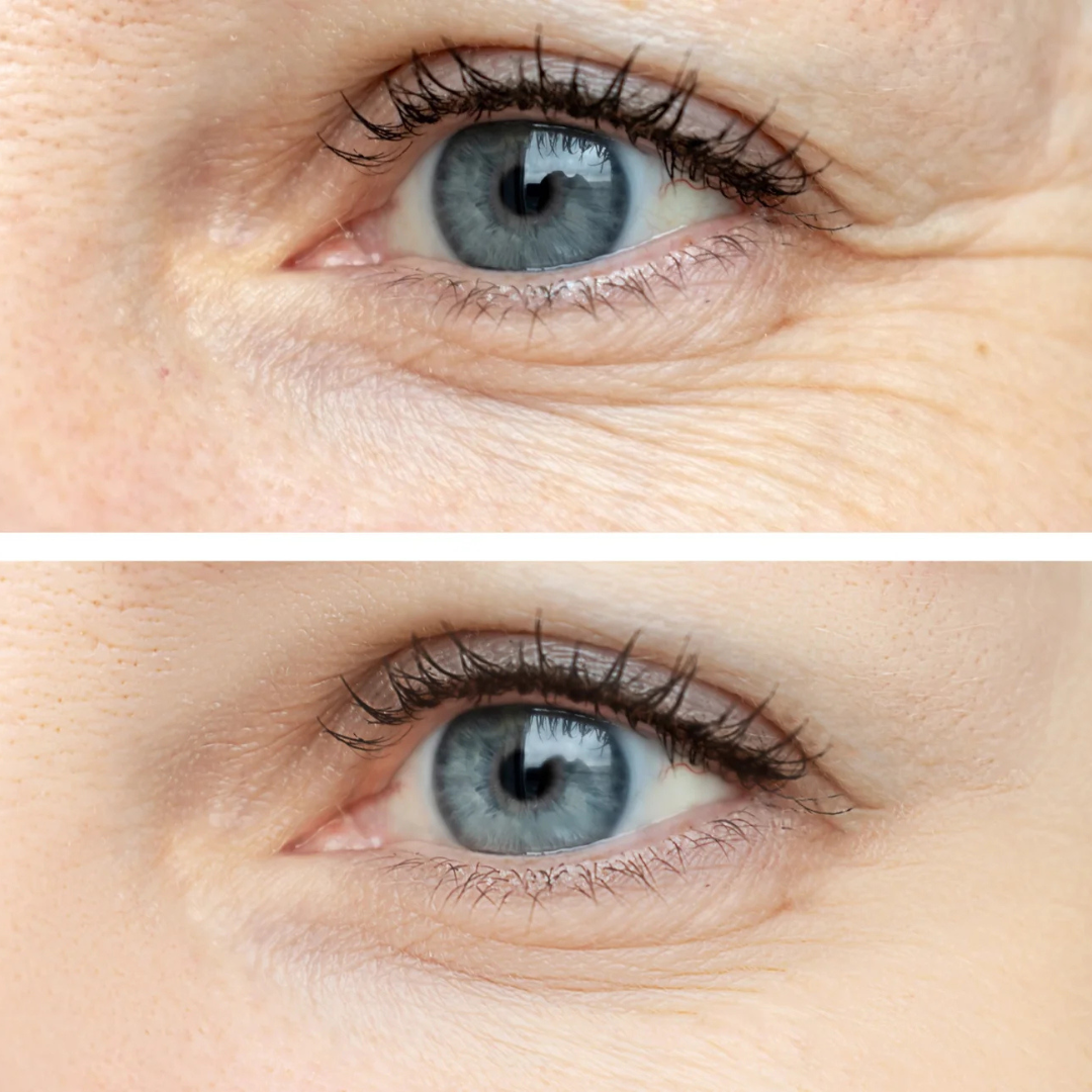 Anti-Aging-Serum