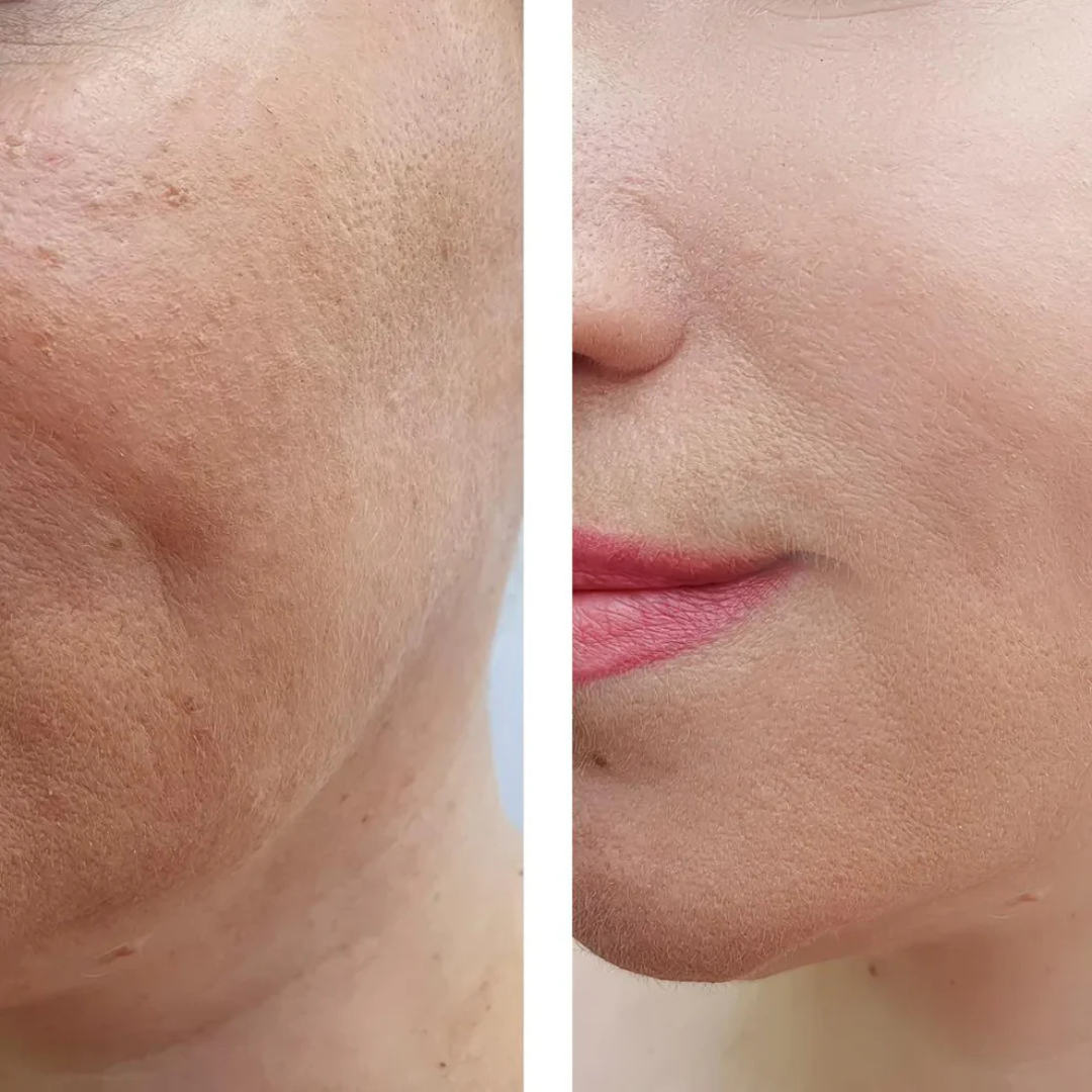 Anti-Aging-Serum