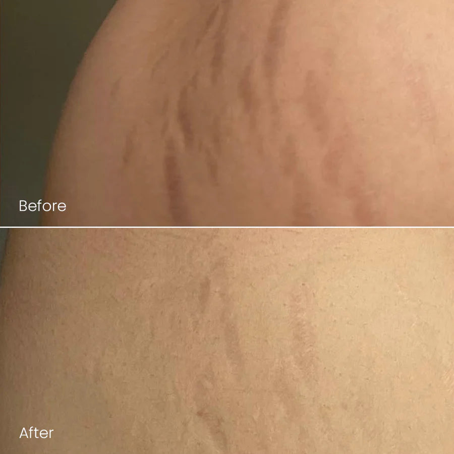 Belaro Firming Body Oil